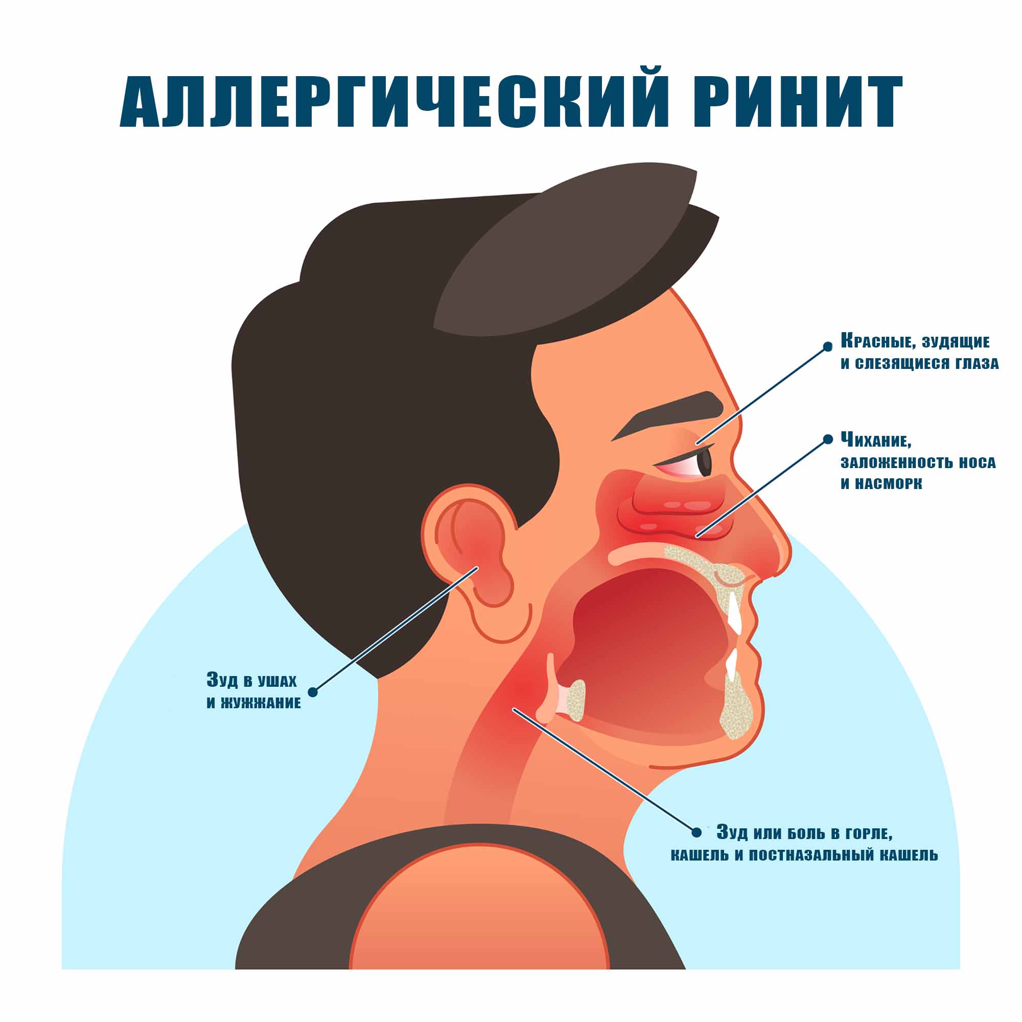 Симптомы